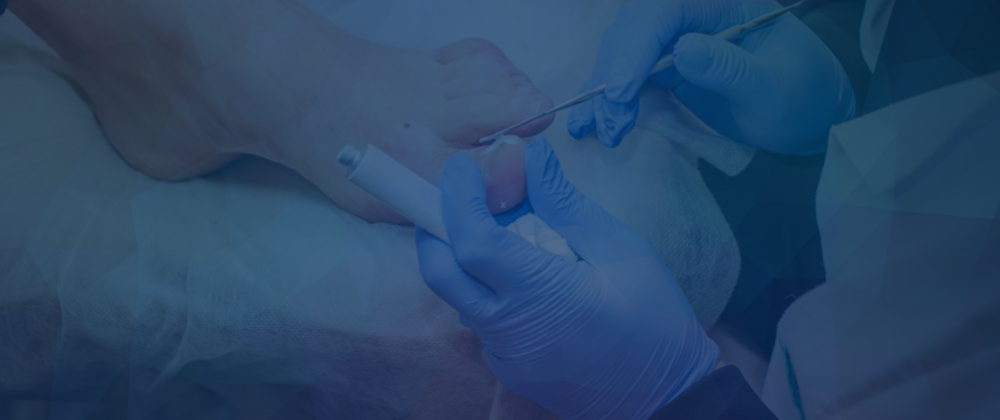 Lower Limb Conditions & Treatments, Podiatrist near me, Sydney Podiatrist